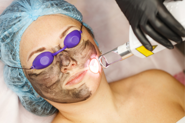 A Precisão do Laser: Tratamentos Específicos para Cicatrizes de Acne